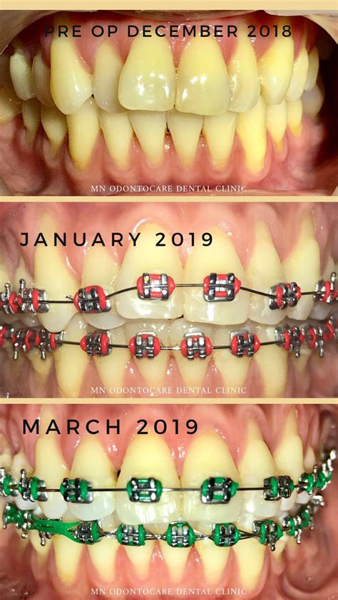 Tecson Carsula Dental Clinic, Unit 2D 2nd flr Corazon Bldg 432 A .